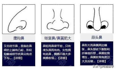 鼻子大 面相|鼻相分析10款｜鼻樑有節及橫紋、豬膽鼻、鼻頭下垂代 